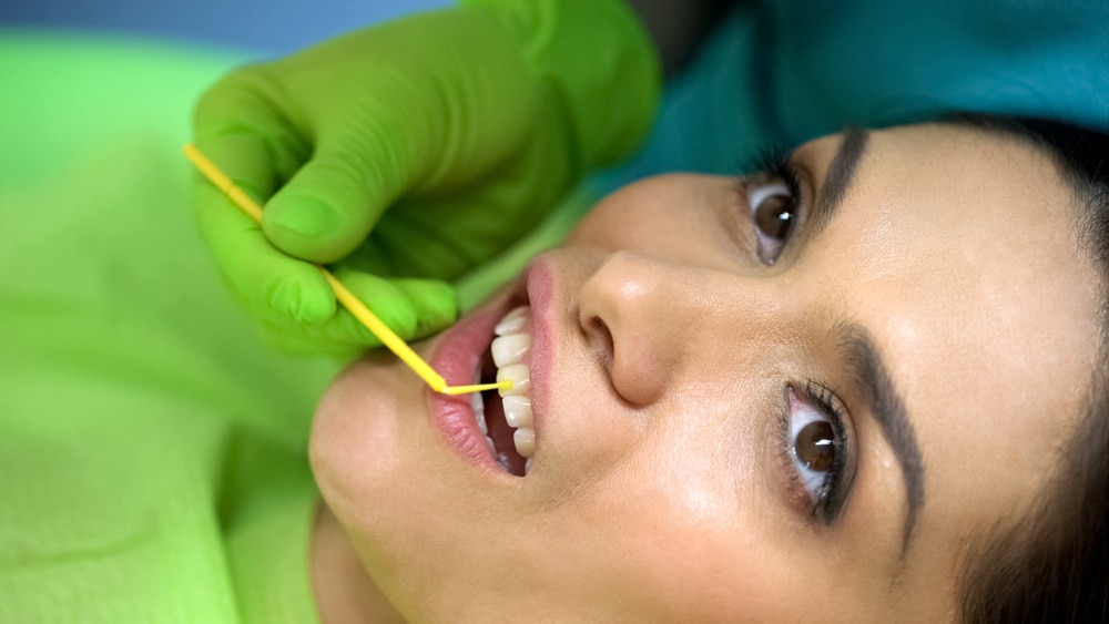 Dental Sealants albany